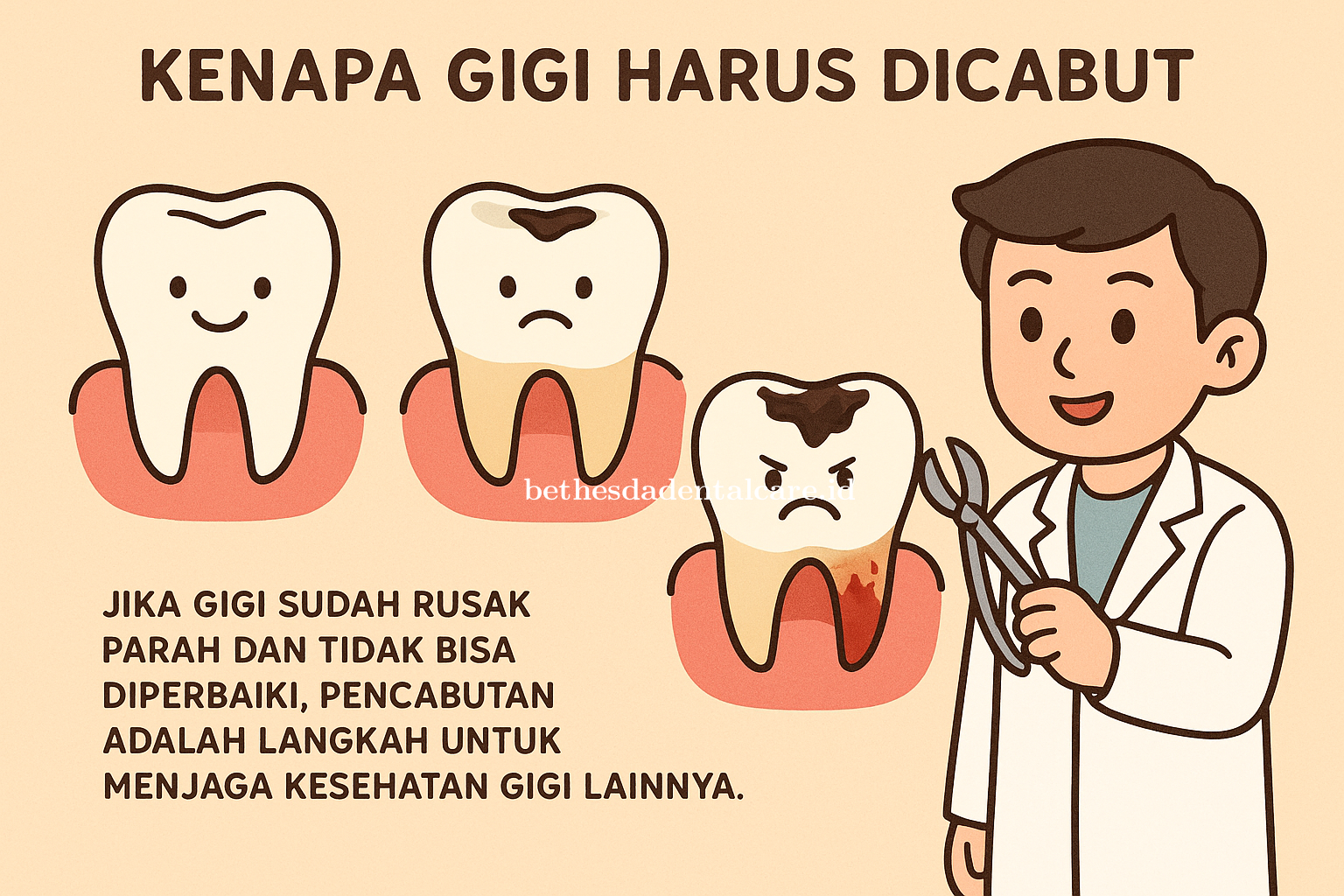 Kenapa Gigi Rusak Harus Dicabut?